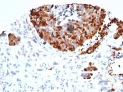 INSM1 Rabbit anti-Human, Clone: INSM1/6286R, Novus Biologicals:Antibodies:Primary